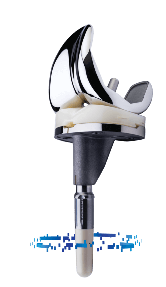 PersonaIQ The Smart Knee showing knee joint replacement with a smart stem